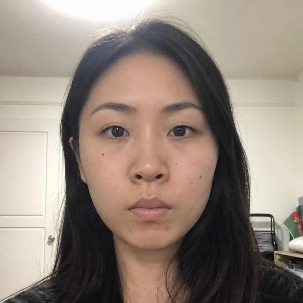 Brow Lift simulation, after