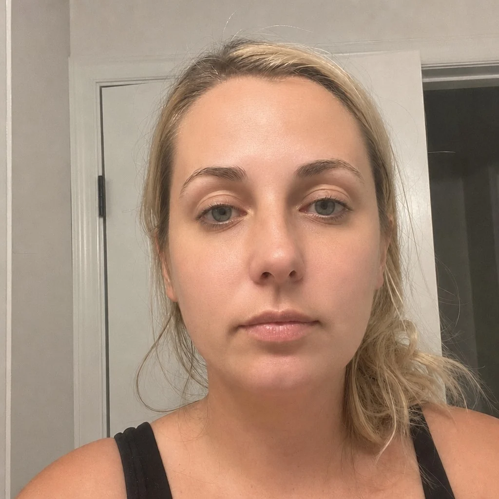 The same face with a skin resurfacing simulation applied by AI