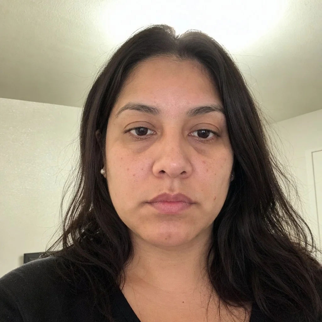 Lip Filler simulation, before