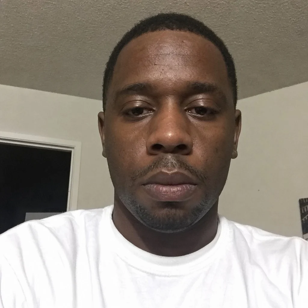 A face before a rhinoplasty simulation
